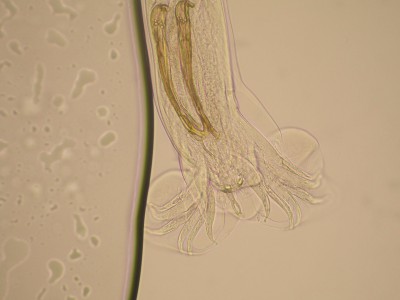 Bourse caudale d'ostertagia, un strongle parasite du tube digestif des bovins